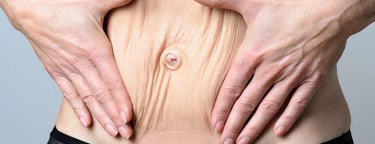 Flacidez tissular e muscular podem ser combatidas com equipamentos de estética. Flacidez tissular e muscular podem ser combatidas com equipamentos de estética.